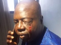 JUST IN: Hoodlums Attack Chairman of Oyo State Sports Council, Hon. Arole