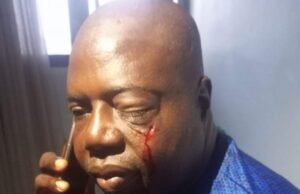 JUST IN: Hoodlums Attack Chairman of Oyo State Sports Council, Hon. Arole